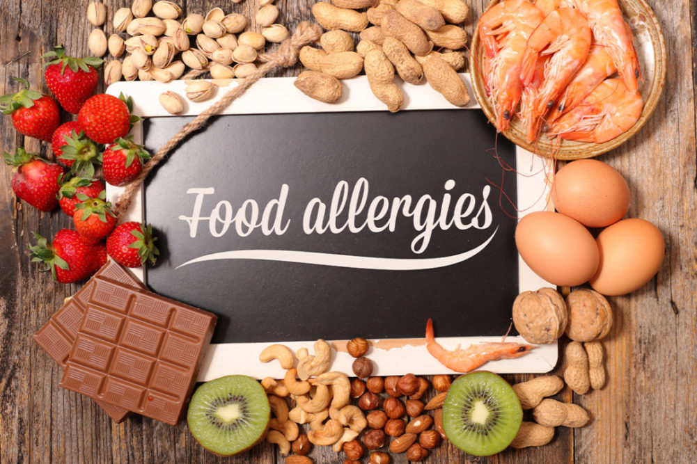 Chalkboard with the words food allergens written on it and surrounded by chocolate bars, peanuts, walnuts, cashews, shellfish, strawberries and eggs
