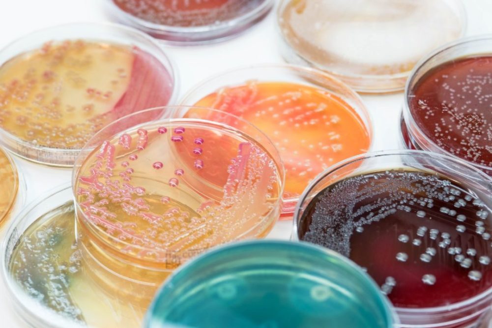 Assorted petri dishes containing pathogen cultures