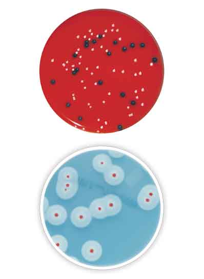 Chromogenic media for Listeria monocytogenes and Bacillus cereus by Bio-Rad Laboratories